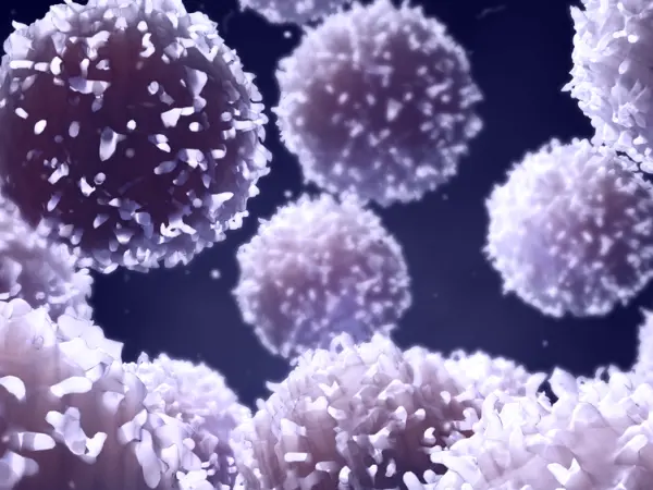 Chronic graft-versus-host disease